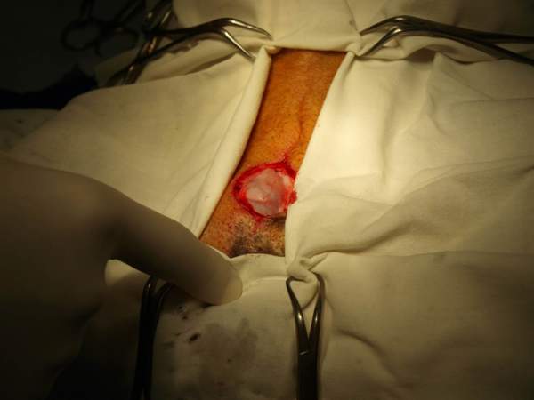 выведение семенника в операционную рану